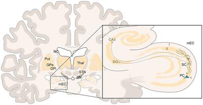 Grid cells: the missing link in understanding Parkinson’s disease?